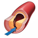 arteries cutaway